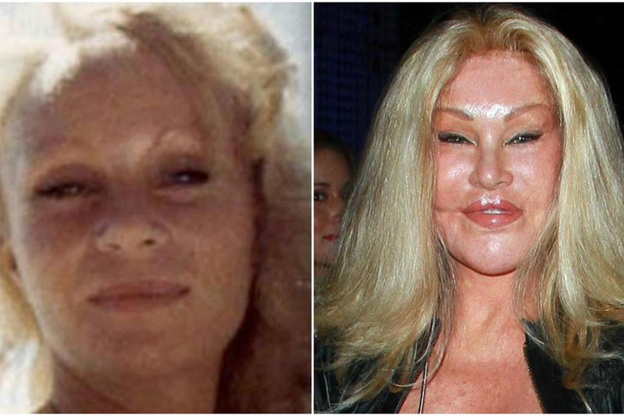 Jocelyn Wildenstein