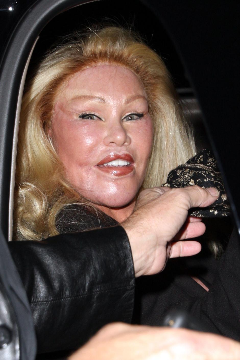 Jocelyn Wildenstein